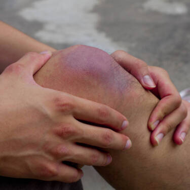 knee injury inflammation